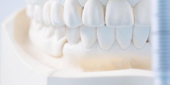 Nahaufnahme eines weißen Zahnmodells mit vollständigem Gebiss, verwendet zur Veranschaulichung von Zahnanatomie oder zur Planung zahnmedizinischer Behandlungen.