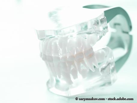 Transparentes Zahnmodell mit vollständigem Gebiss, seitlich fotografiert, auf hellem Hintergrund